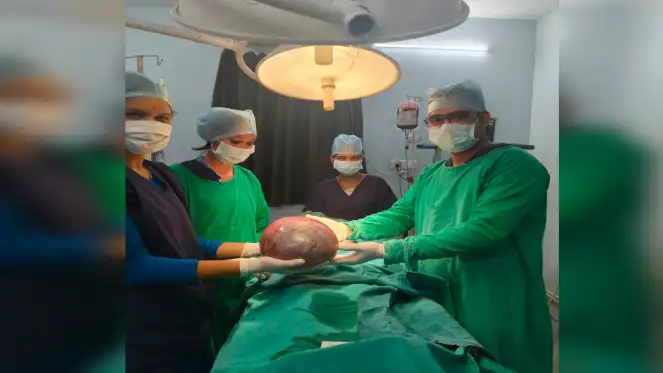 महिला दर्द से परेशान, पेट में था 6 किलो का ट्यूमर, कलश के डाक्टरों ने दी नई जिंदगी