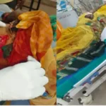 तेंदूपत्ता तोड़ने गए ग्रामीणों पर जंगली सूअर का हमला, 10 घायल