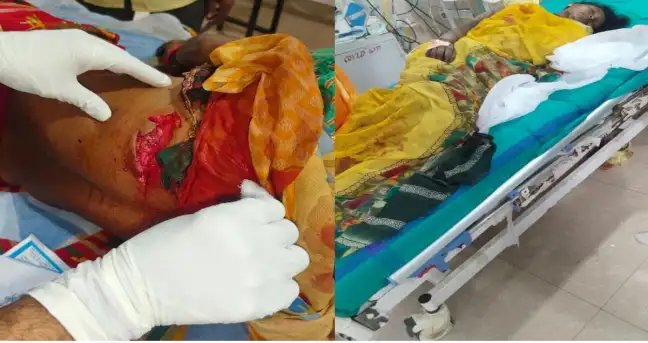 तेंदूपत्ता तोड़ने गए ग्रामीणों पर जंगली सूअर का हमला, 10 घायल